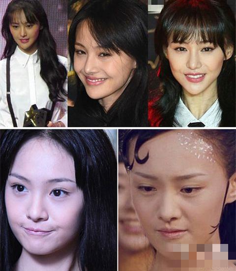 女明星整容前后照片對比照片，美麗背后的故事，女明星整容前后對比照，美麗背后的故事揭秘