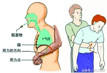如何避免在自助餐中吃出異物——享受美食的同時(shí)保障健康，自助餐安全指南，如何避免異物，享受健康美食