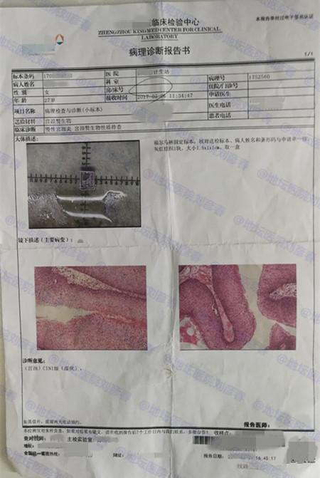 濕銳尖疣的根治之道，理解與探索，濕銳尖疣的徹底根治之路，理解與探索