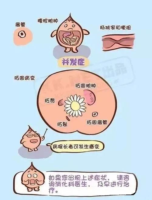 克羅恩病最常見的癥狀及其影響，克羅恩病常見癥狀及其影響概述