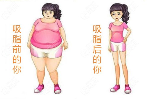 哈爾濱吸脂手術的專業(yè)醫(yī)療機構解析，哈爾濱專業(yè)醫(yī)療機構解析，吸脂手術詳解