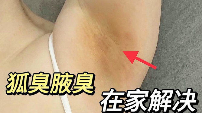 腋下異味與狐臭的判斷，如何準(zhǔn)確識(shí)別腋下異味是否為狐臭？，腋下異味與狐臭的識(shí)別，如何準(zhǔn)確區(qū)分腋下異味是否為狐臭？