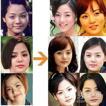 女演員整容前后的變化與探討，女演員整容前后的變化深度探討