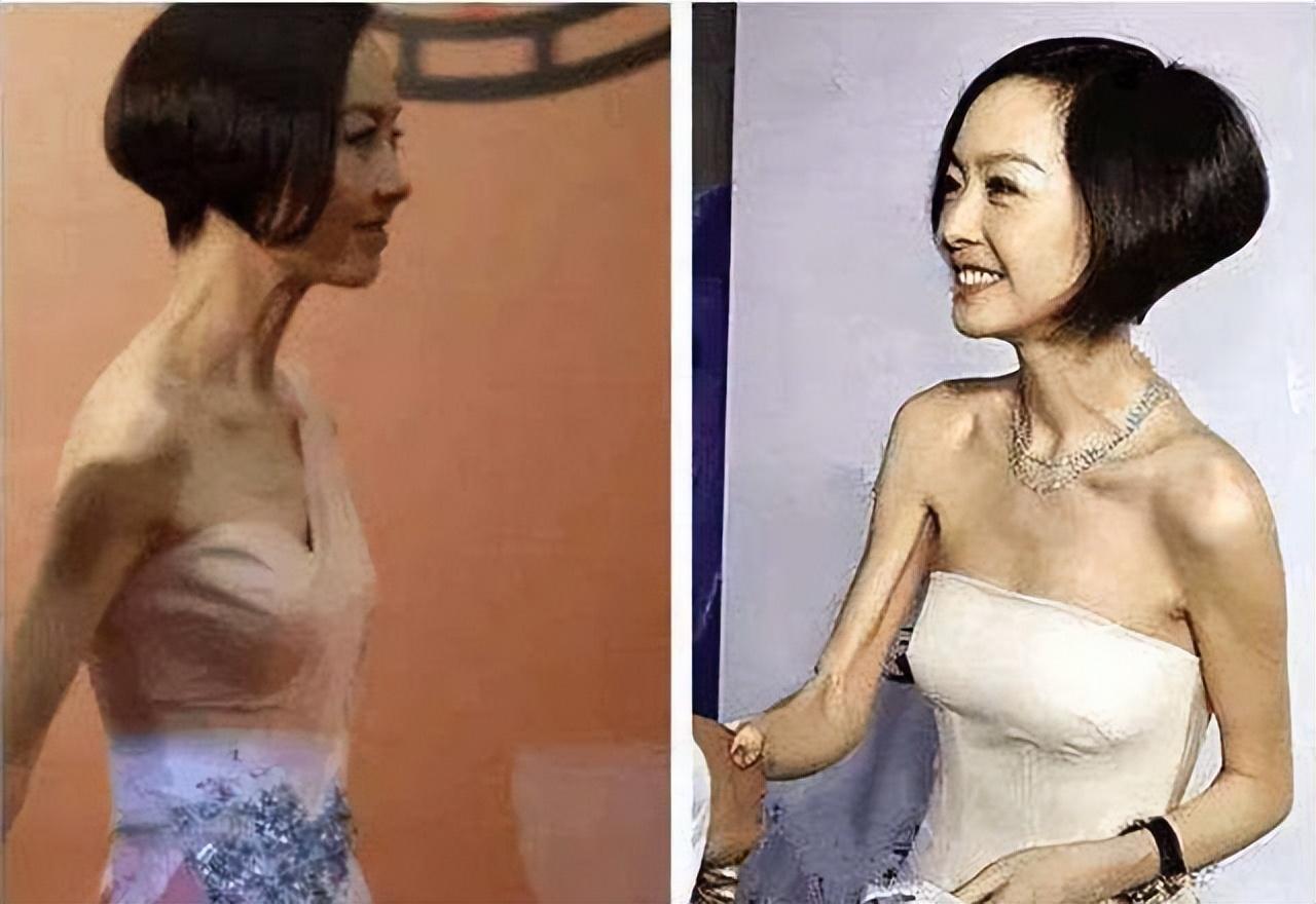 瘦得驚人的女明星，身體語言與社會壓力下的自我表達，瘦得驚人的女明星，身體語言與社會壓力下的自我表達挑戰(zhàn)