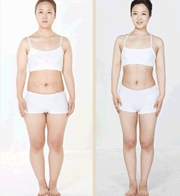 抽脂手術(shù)后的痛苦經(jīng)歷，抽脂手術(shù)后的艱辛歷程